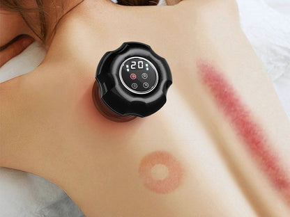 🔥 Ventouses Massage Électriques 🔥 جهاز الحجامة الكهربائية الذكي